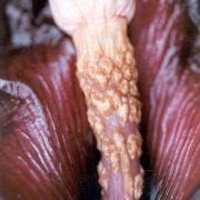 Image of Amorphophallus angulatus  Hett. & A. Vogel.